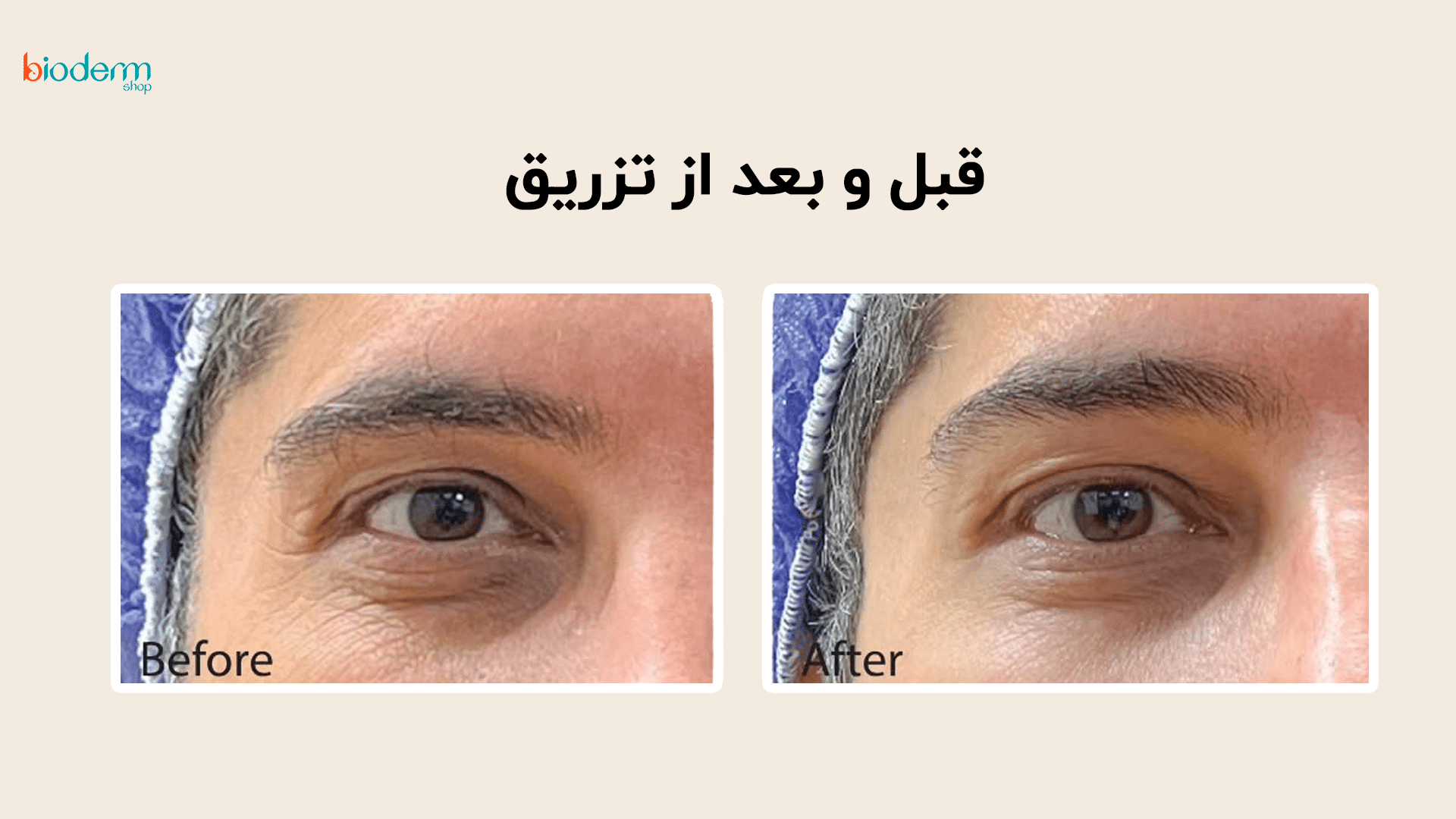 before / after