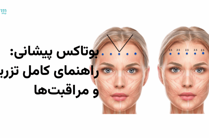 بوتاکس پیشانی؛ راهنمای کامل و مراقبتها