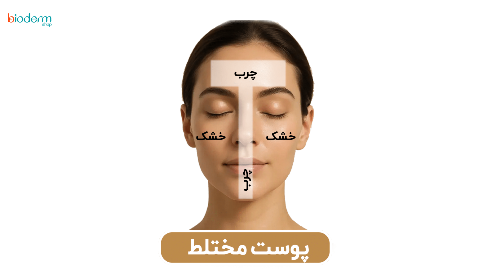 پوست مختلط